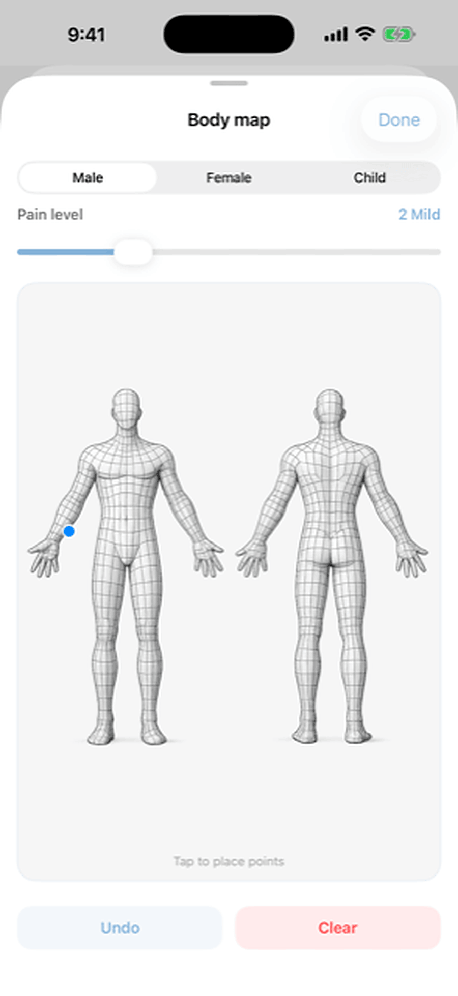 Body map with a marked point on the forearm